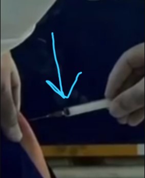 Vídeo mostra secretária de Saúde tomando vacina com seringa aparentemente vazia?